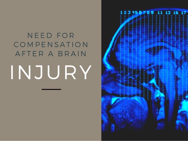 1the need for compensation after a traumatic brain injury tbi 1 638