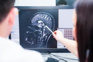 doctors review brain scan
