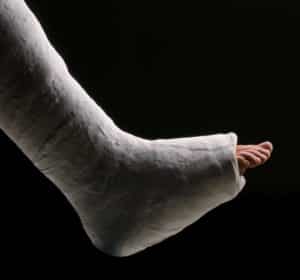 foot injury 1