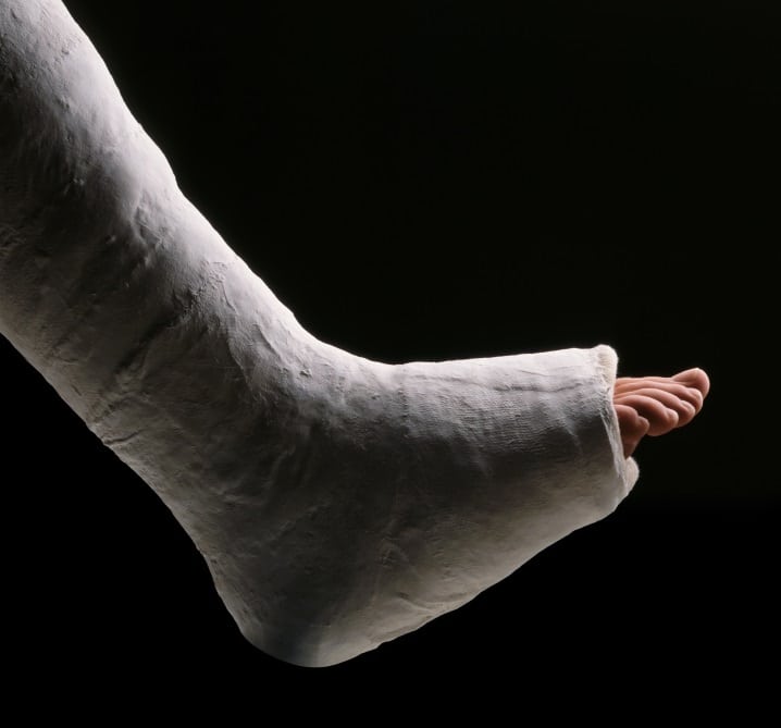foot injury