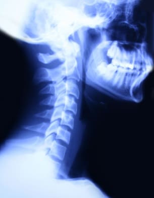Motorcycle Accident Lawyer Fort Collins CO