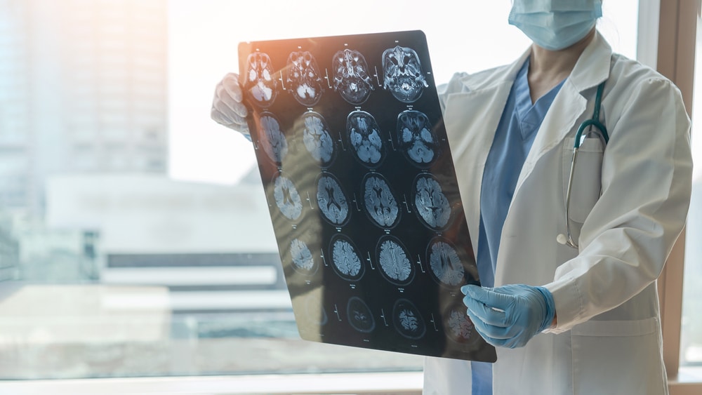 A doctor looking at a patient's scans after a brain injury in Boulder, CO