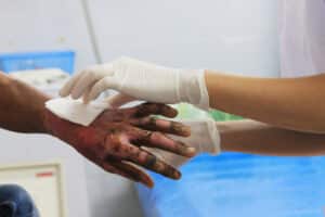 A doctor wrapping the hand of a man with a burn injury in Boulder, CO